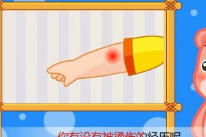 56如果遇到烧烫伤怎么办